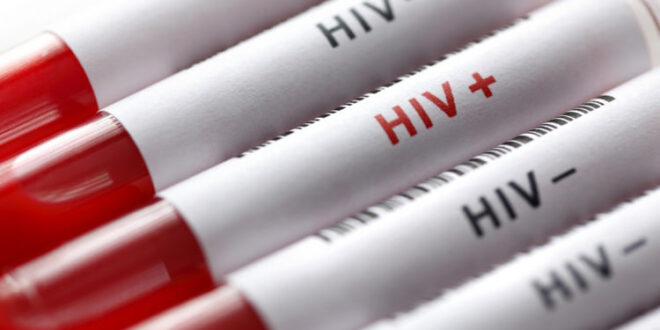 آزمایش ایدز | این افراد حتما باید آزمایش اید HIV (تست اچ آی وی) بدهند