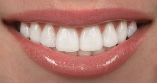 ارتودنسی دندان بهتر است یا کامپوزیت دندان؟