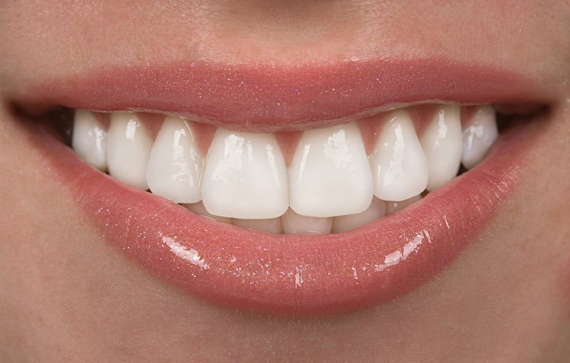 ارتودنسی دندان بهتر است یا کامپوزیت دندان؟